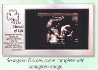 SONOGRAM FRAME 4X6